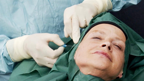 9. Medical Webinar – PDO Fadenlifting